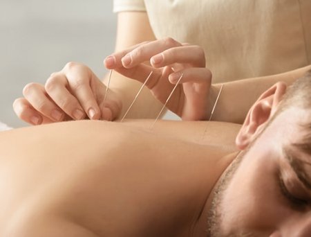 Accupuncture Accupuncture in Milton Keynes